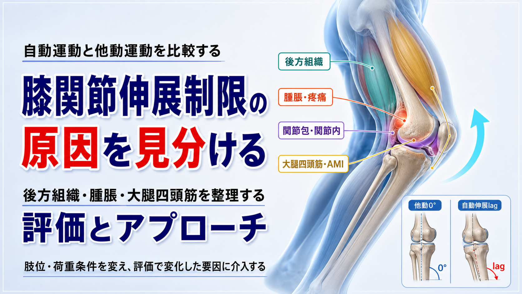 膝関節伸展制限の原因を見分ける｜後方組織・腫脹・大腿四頭筋を整理